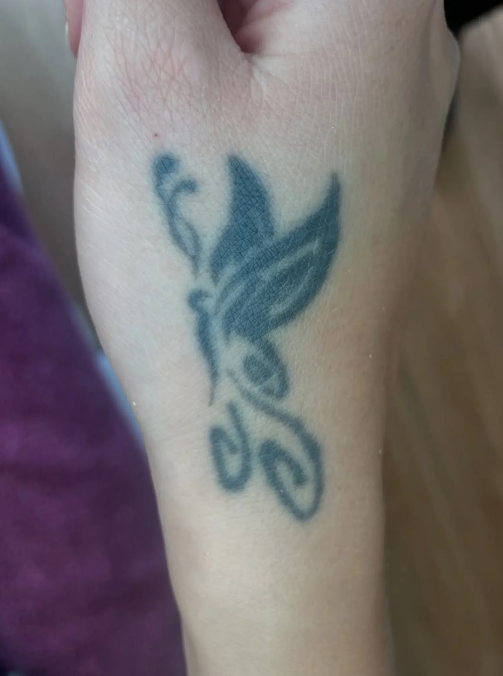saline tattoo removal