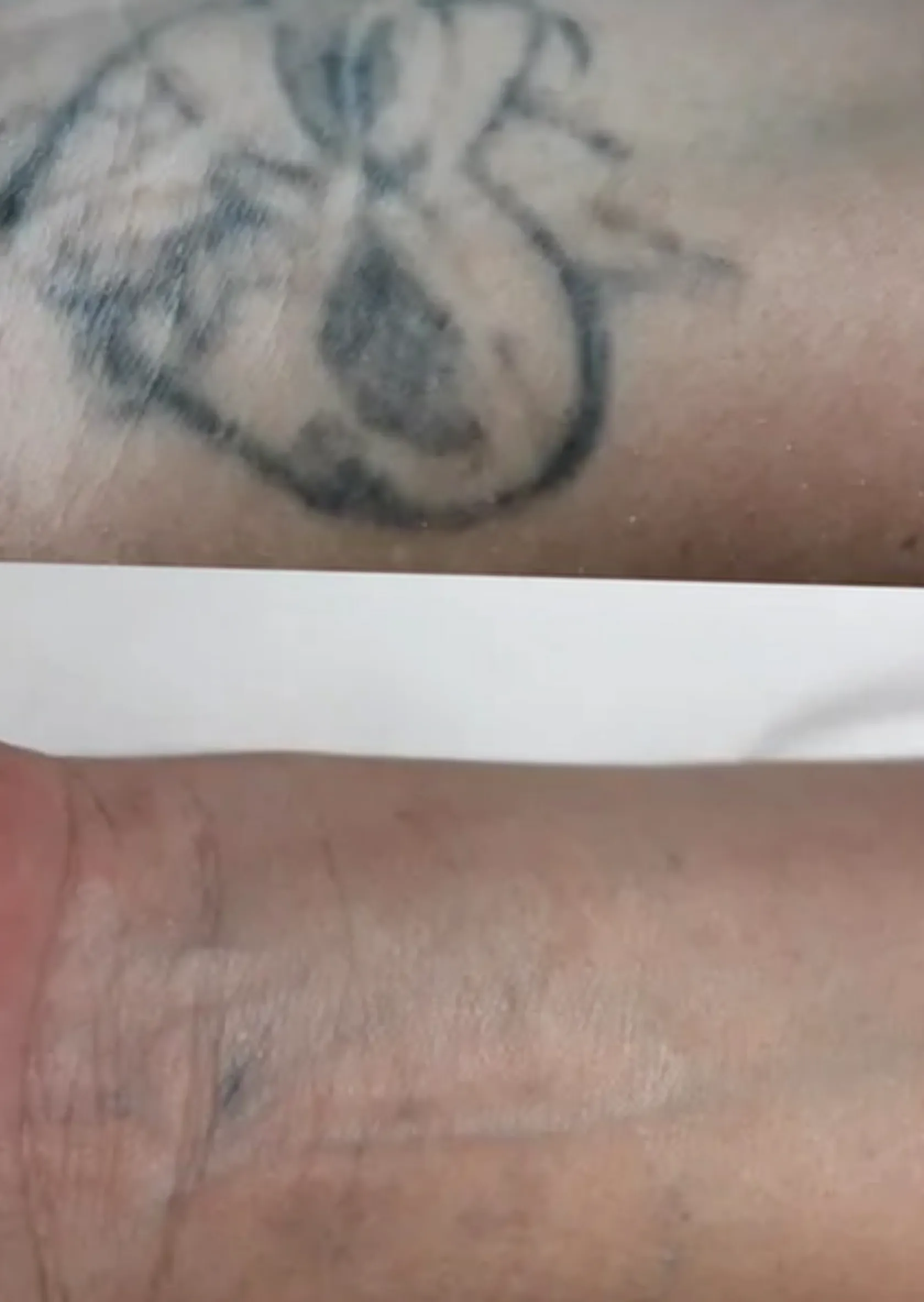 causes of tattoo fading