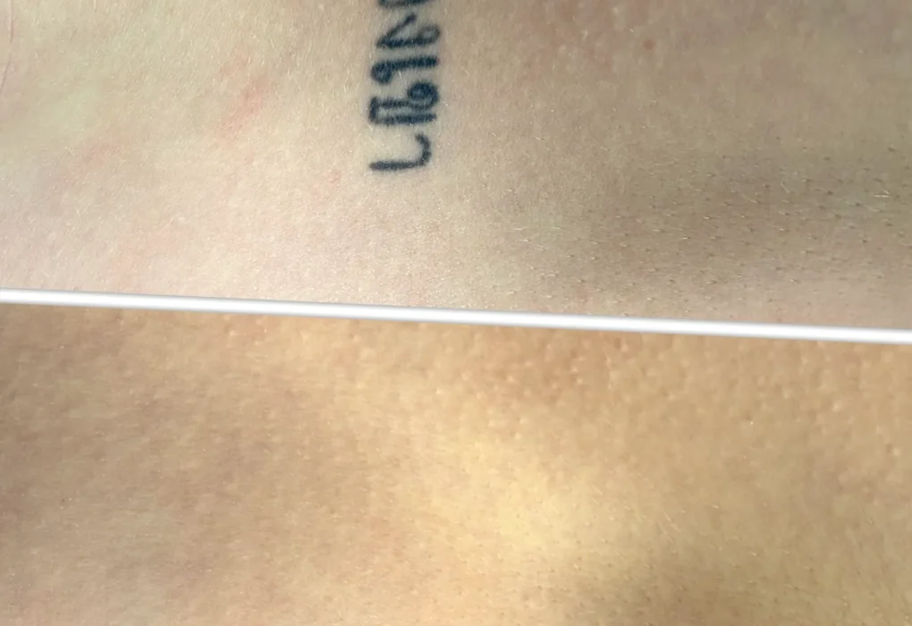 why do tattoos fade fast