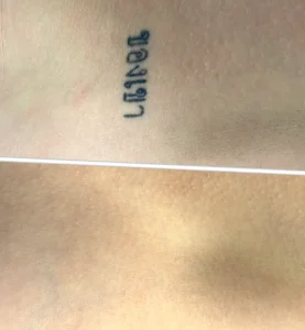 why do tattoos fade fast