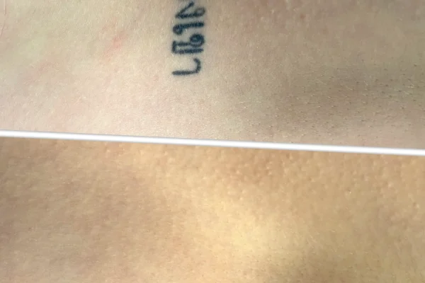 why do tattoos fade fast