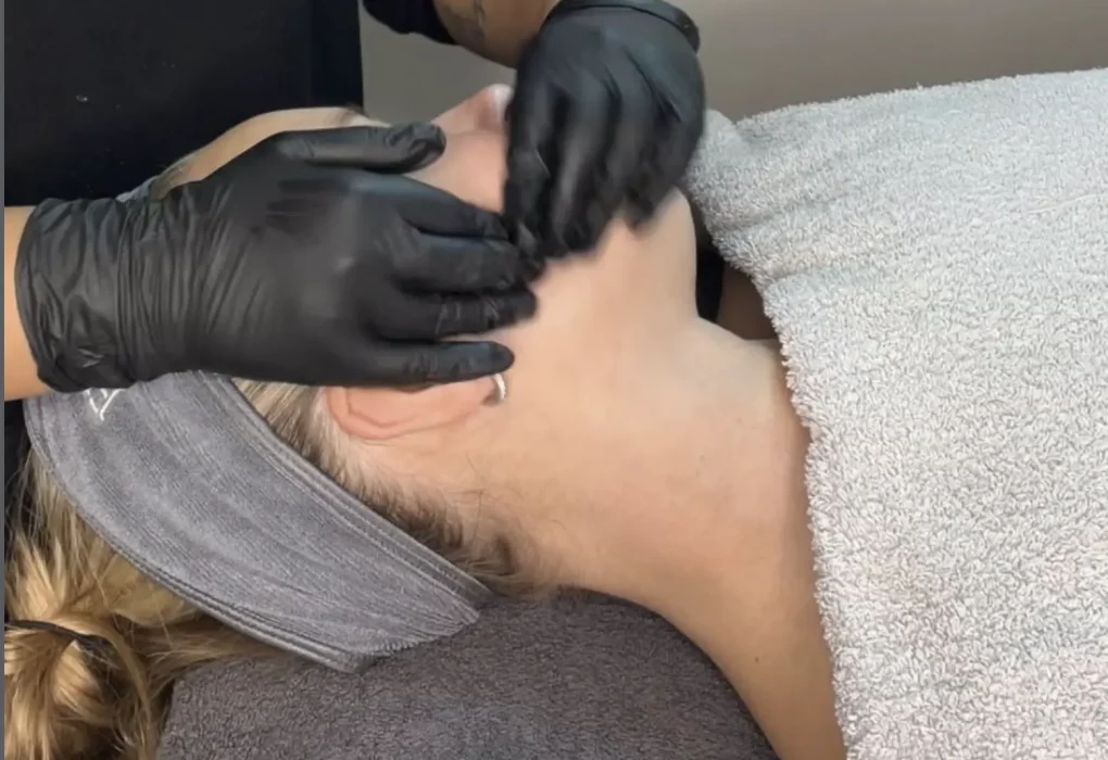 buccal massage before and after