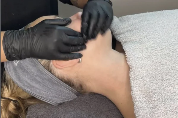 buccal massage before and after