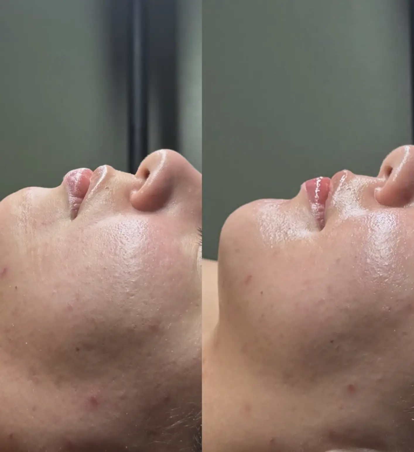 buccal massage tmj