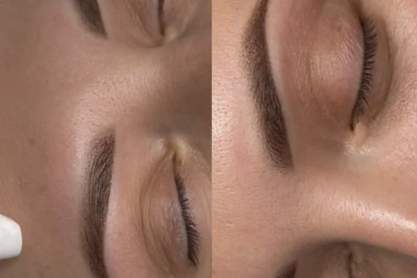 eyebrow tattoo aftercare