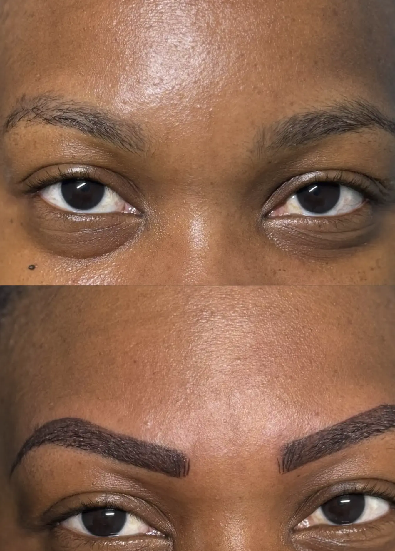 eyebrow tattoo removal near me