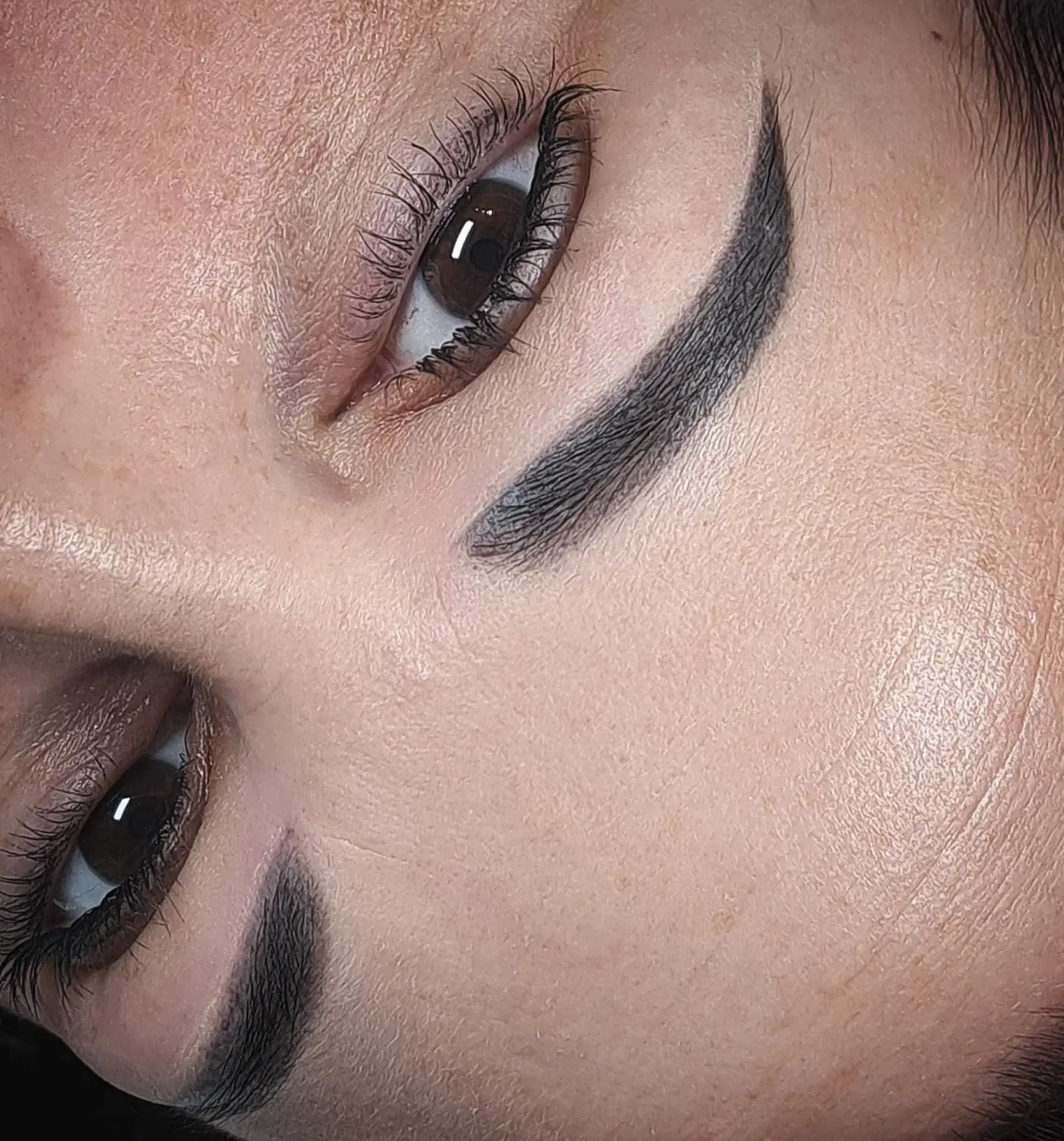 laser eyebrow tattoo removal